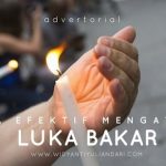 cara efektif mengatasi luka bakar